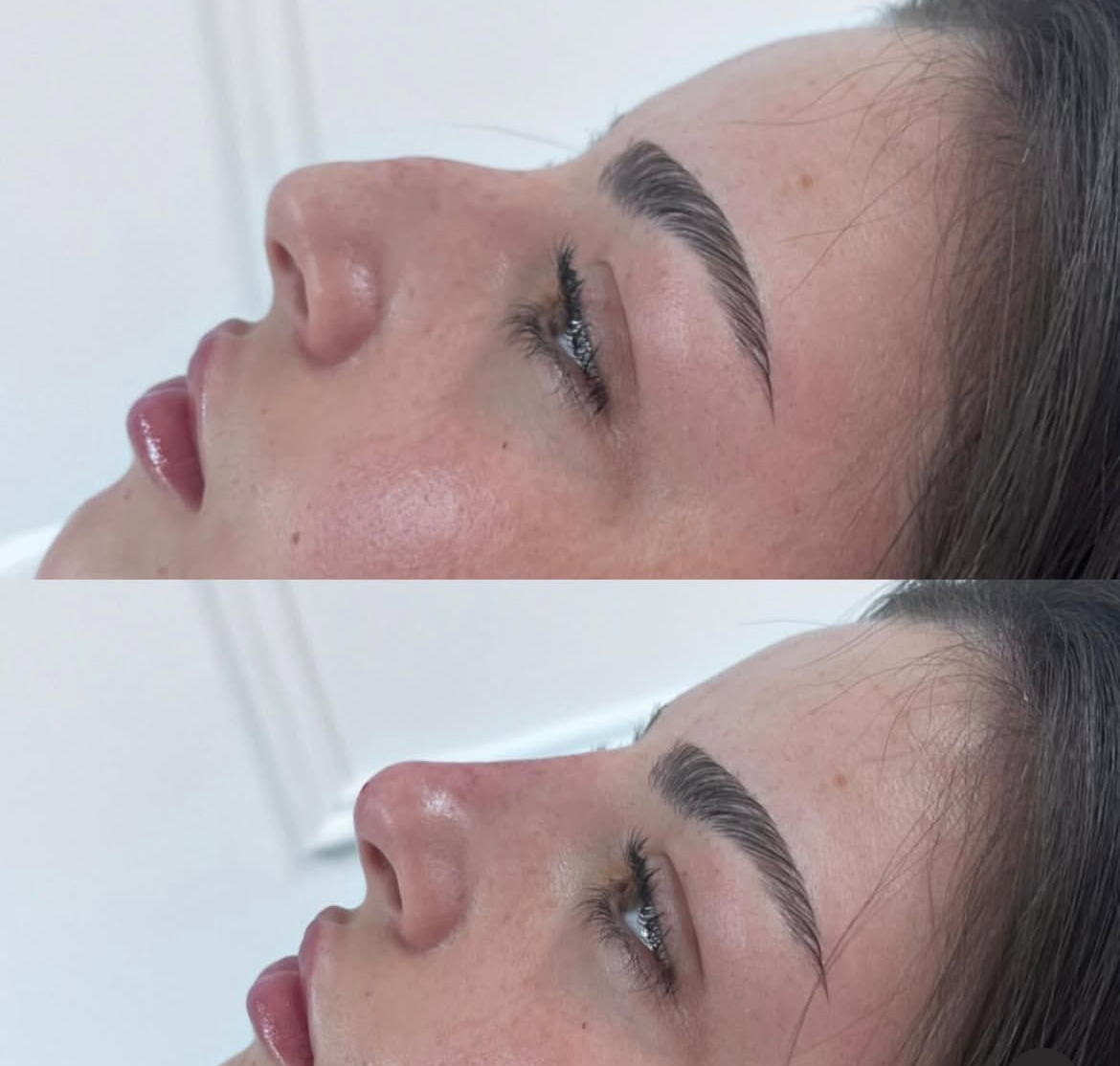 Straighter bridge enhancement result